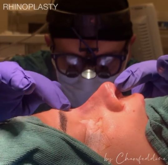 Eden Plastic Surgery Institute Dr. Ali Charafeddine during the surgery.