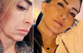 EVE Lift Before and After