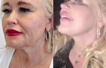 EVE Lift Before and After