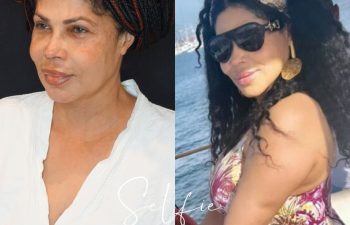 female patient before and after EVELift®