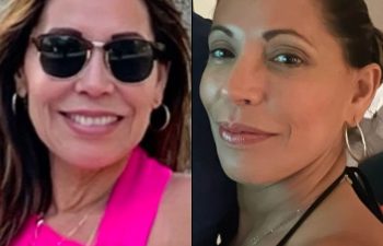 female patient before and after EVELift®