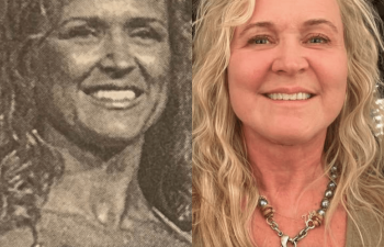 female patient before and after EVELift®