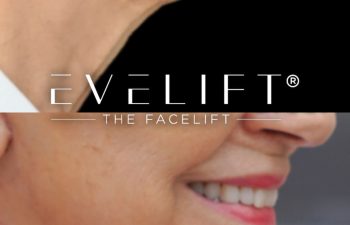 female patient before and after EVELift®