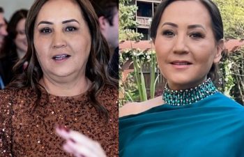 female patient before and after EVELIFT®