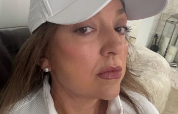 female patient before and after EVELIFT®