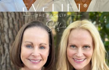 female patient before and after EVELIFT®