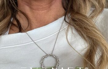 female patient before and after EVELIFT®